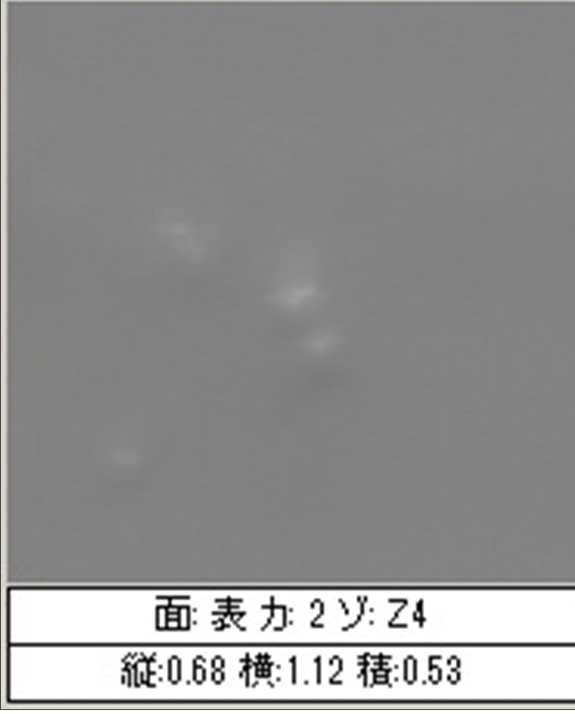 写真：検出例4